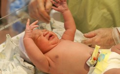 Objętość płuc płodów jest znacząco zmniejszona u ciężarnych z SARS-CoV-2