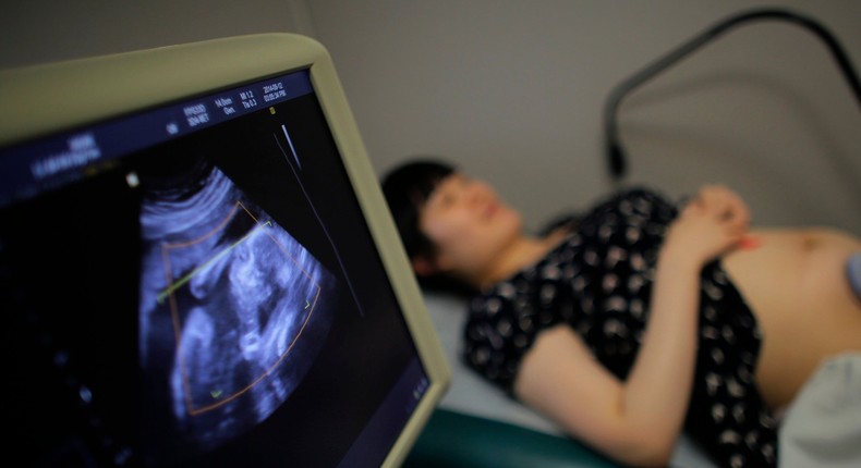 A pregnant woman attends a sonogram at a local hospital in Shanghai..JPG