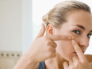 Íme egy mitesszergyilkos páros, ha meguntad a fekete pöttyöket