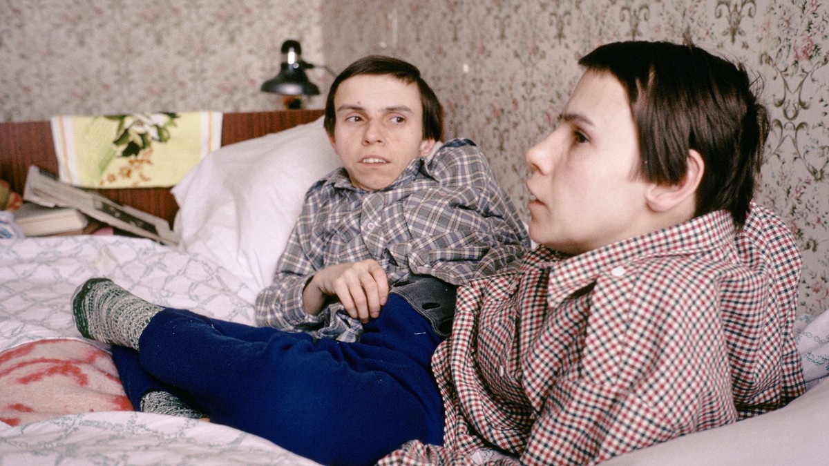 Sijamske bliznakinje Maša i Daša