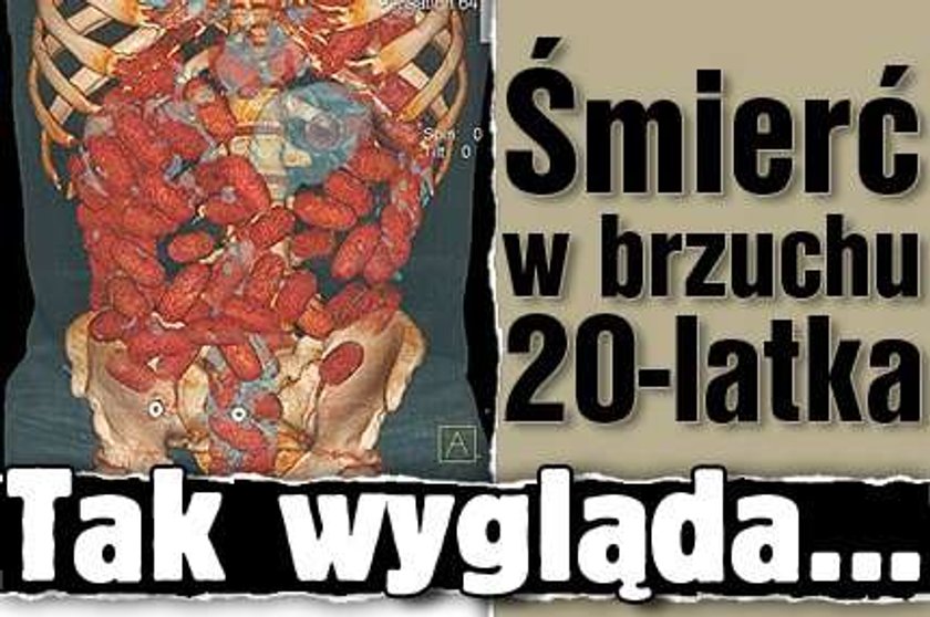 Śmierć w brzuchu 20-latka. Tak wygląda...