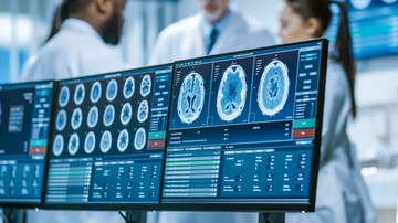 Agysorvadás diagnózissal mire számíthatunk? Vakcinainfó - Az orvos válaszol
