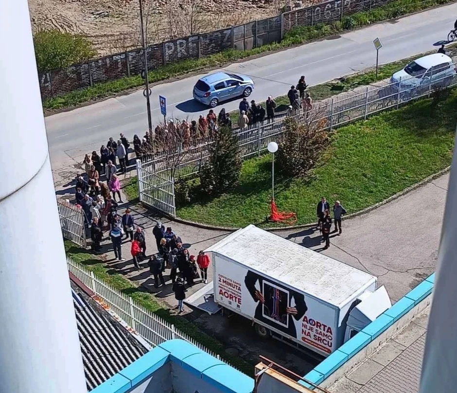 Pregledi stomačne aorte