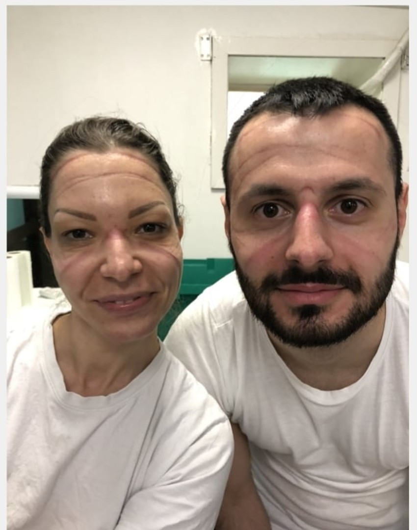 Anesteziolog dr Milena Stojanović i anestetičar viši medicinski tehničar Nikola Trajković 