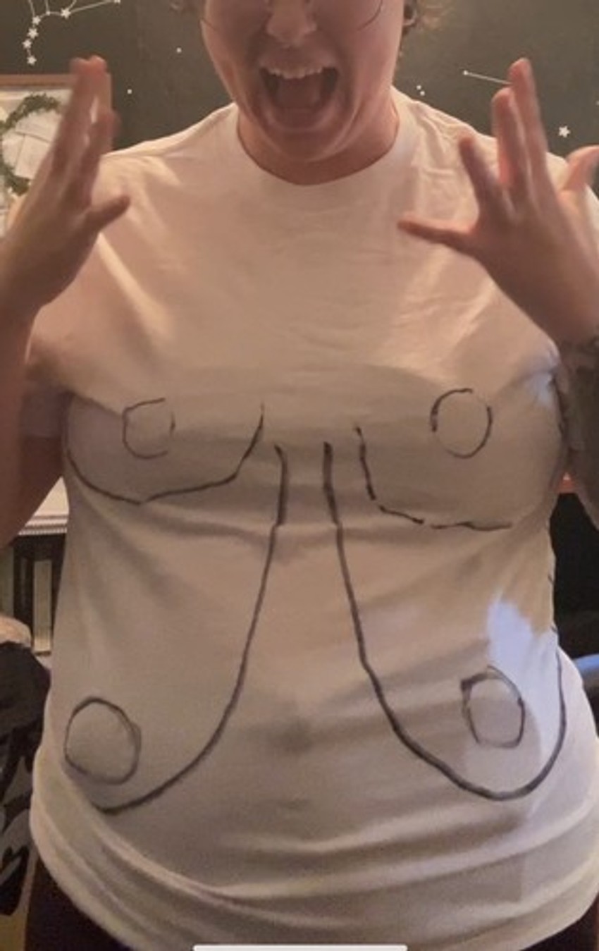 Žena morala da smanji grudi