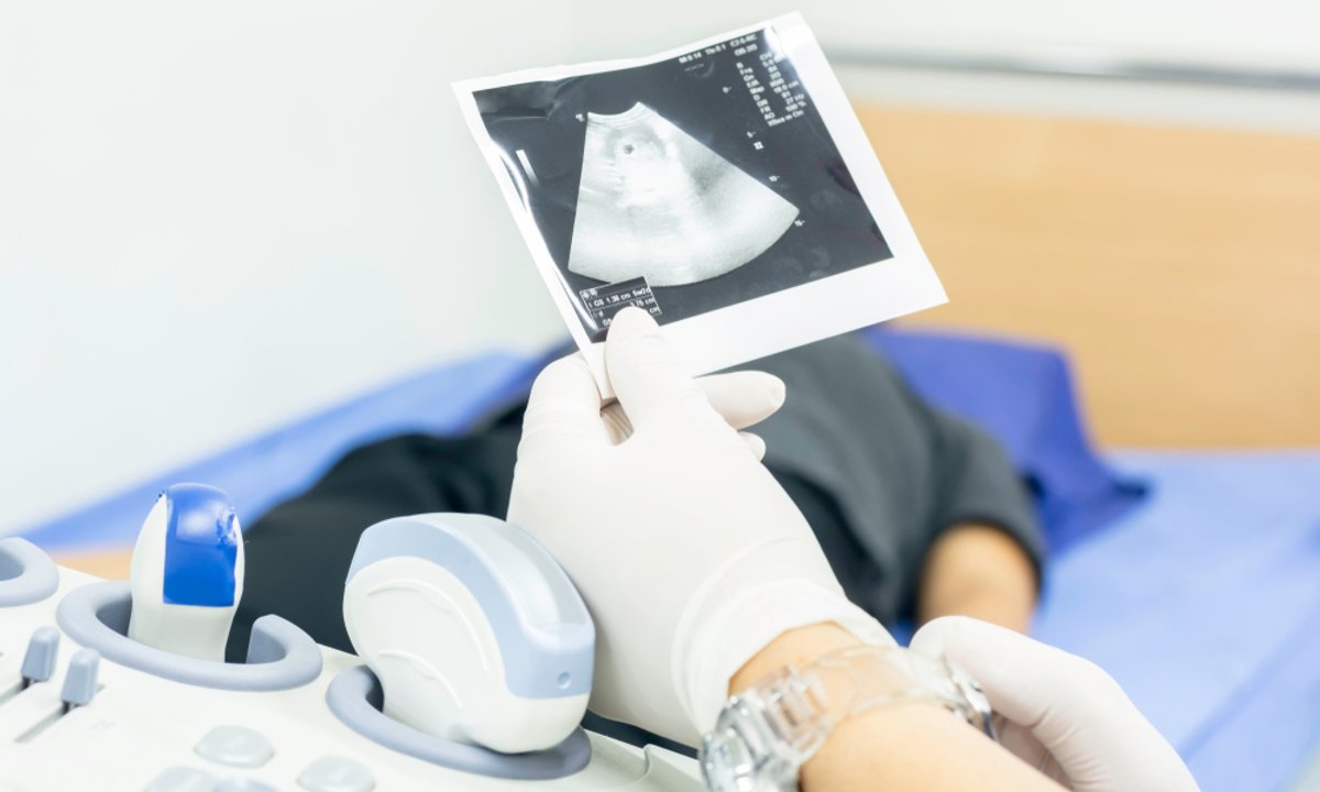 To miał być rutynowy zabieg. Pękła jej macica. Kobieta straciła dziecko