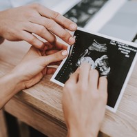 A kisbabám nyakára duplán rá van tekeredve a köldökzsinór, mit lehet tenni? Az orvos válaszol
