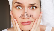 Jak usunąć wągry na nosie?