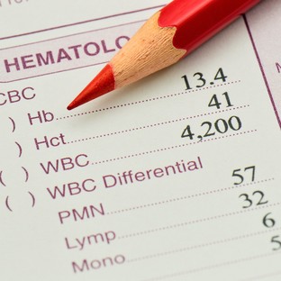 Mit jelent a hematokrit (Htc) érték a laborleleten?