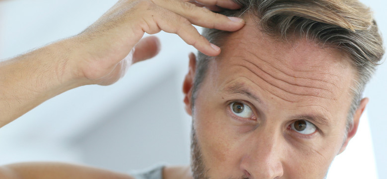 Jak zatrzymać łysienie? Sposoby na wypadanie włosów