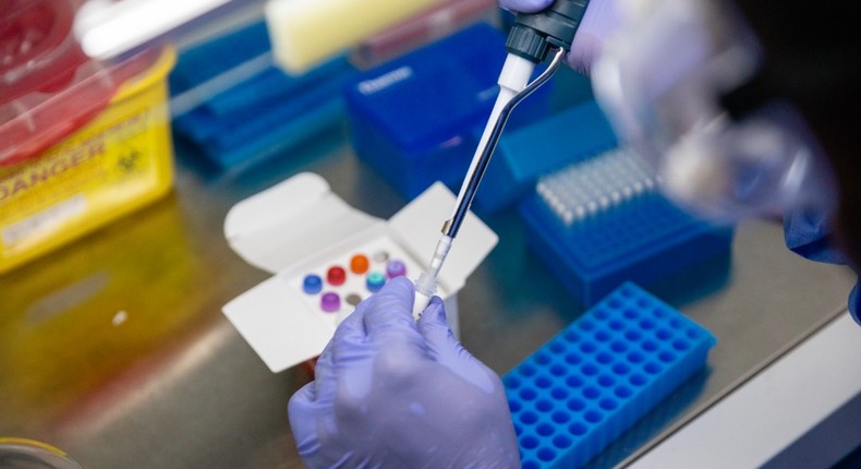 Coronavirus (COVID-19) test in a Nigerian lab [NCDC]