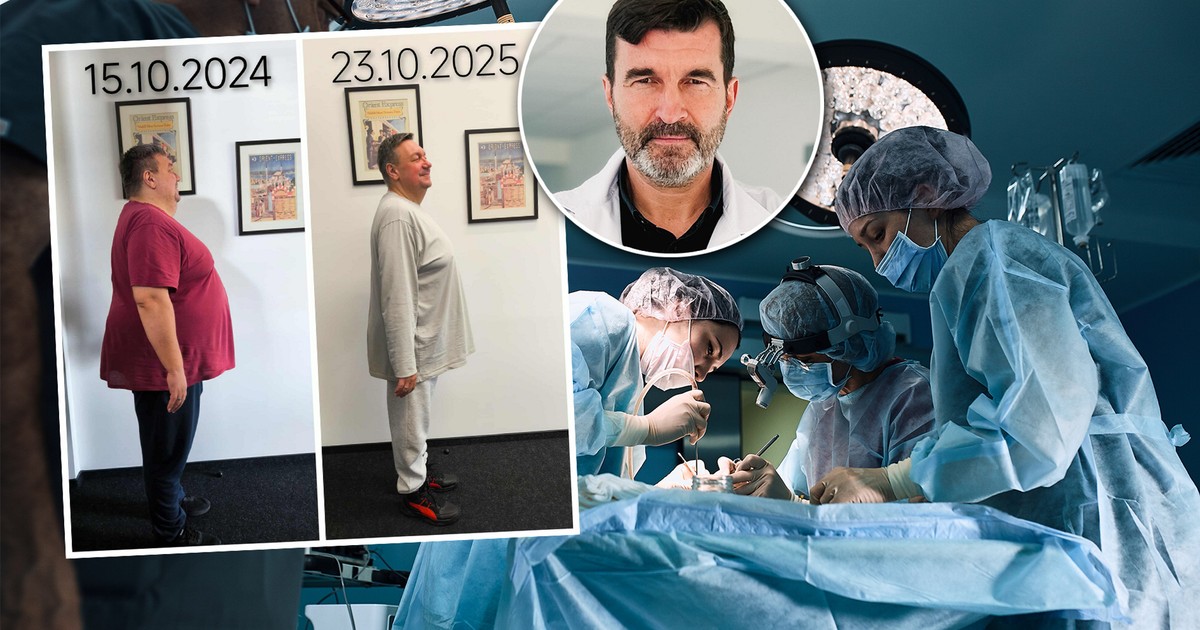 Zmniejsza żołądki setek pacjentów rocznie. "To nie jest droga na skróty"