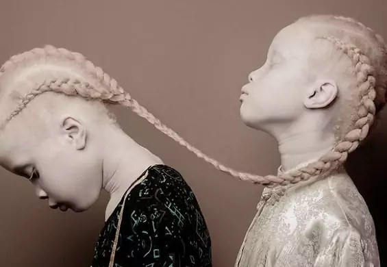 Zobacz nieziemską sesję brazylijskich albinosek. Podpisały kontrakt z Nike i Baazar Kids