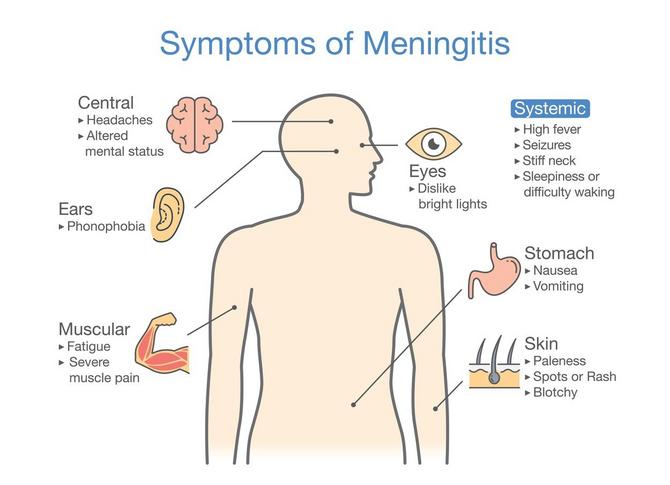 Simptomi meningitisa