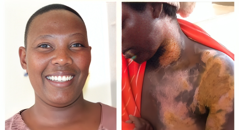 Doreen Atwongeirwe, a lectuerer at BSU is accused of scalding her housemaid Anita Kansiime