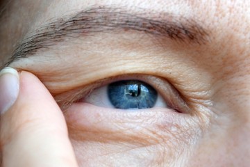 szemhéj-csüngés, fáradékonyság, gyengeség, nyelési nehézség, autoimmun betegség, myasthenia gravis