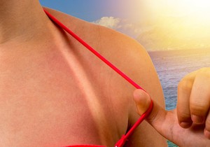 sorti_domaci_lek_protiv_opekotina_vesti_blic_safe_sto