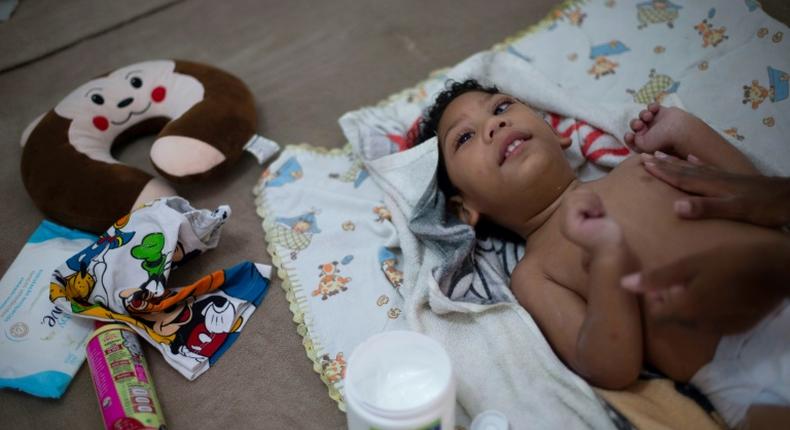 Brazilian Thamires Ferreira da Silva, 29, changes her two-year-old son Matheus, who was born with microcephaly