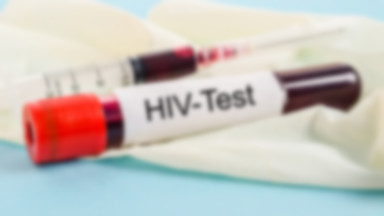 Naukowcy odkryli nowy szczep wirusa HIV. Pierwszy od dwóch dekad