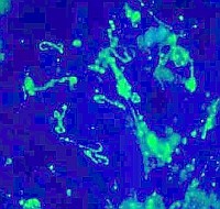 leptospira-d00001CA8266c839ffbac