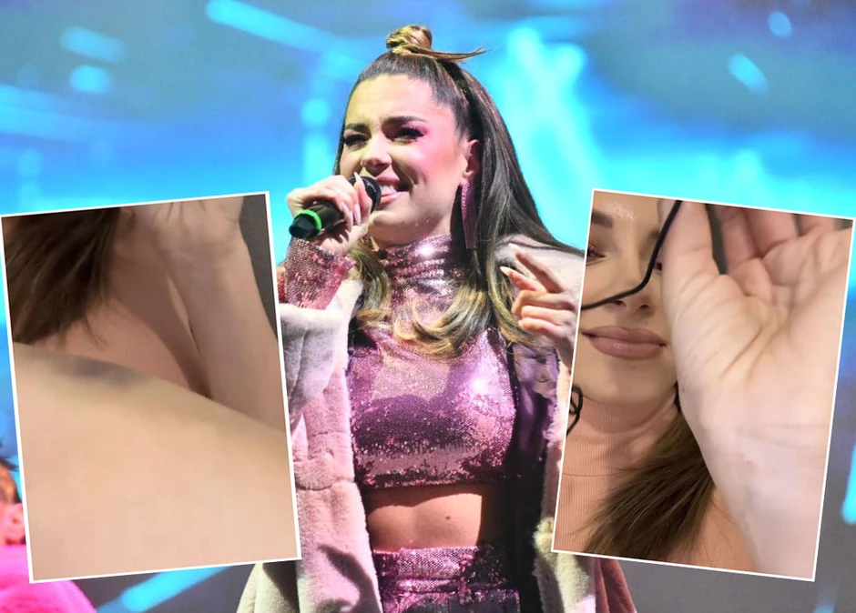 Sara Jo dobila modrice nakon pada