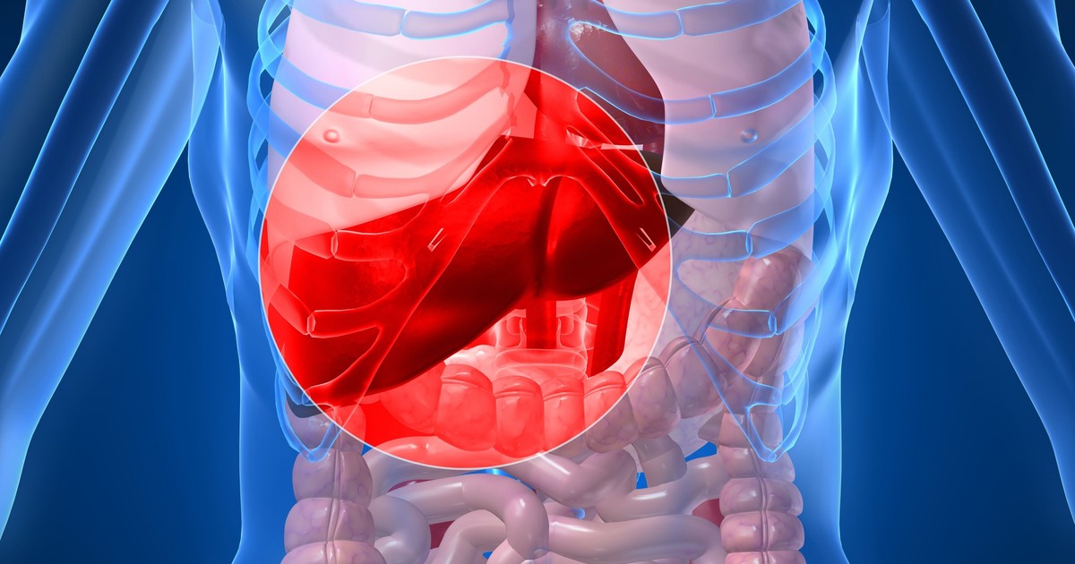 Ten objaw może być oznaką stłuszczenia wątroby, która grozi poważnymi powikłaniami. Gastrolog ostrzega