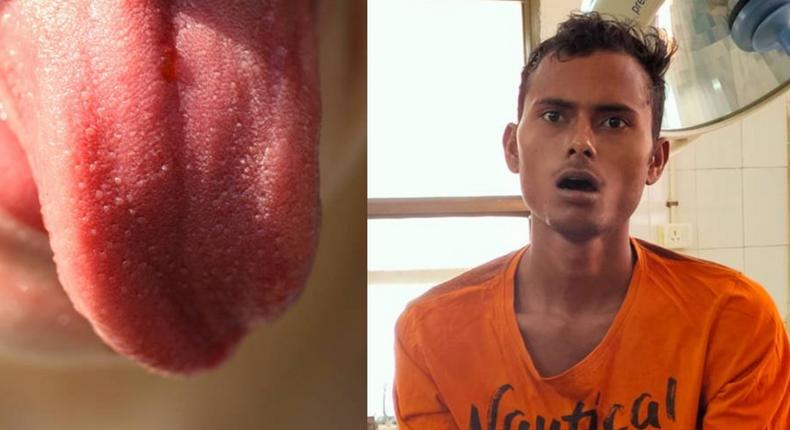 ‘Concerned’ man cuts off his tongue for sacrifice to stop the spread of COVID-19