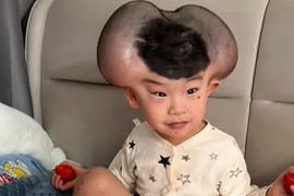 Zbog jezive bolesti zadirkivali su ga da je "MIKI MAUS", a njegova majka je samo BRISALA SUZE, ali nije odustala i dečak danas izgleda potpuno NEPREPOZNATLJIVO