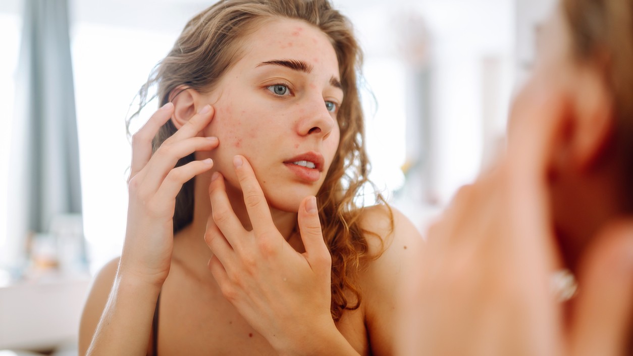 Prestaňte hovoriť o nečistej pleti a začnite ju skutočne liečiť.