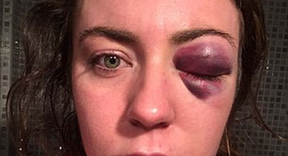 22-year old woman punched by a stranger because he didn't like her clothes