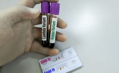 Wariant Kappa atakuje w Belgii. Zmarło siedmiu seniorów