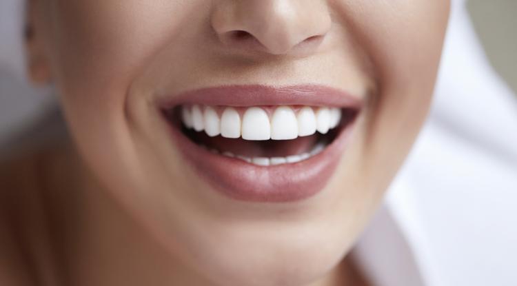 Ezek a gyógyszerek károsíthatják a fogsorodat. Fotó: Getty Images