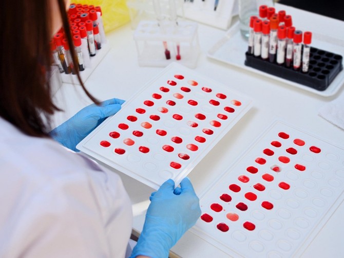 Ljudi sa nultom krvnom grupom žive duže