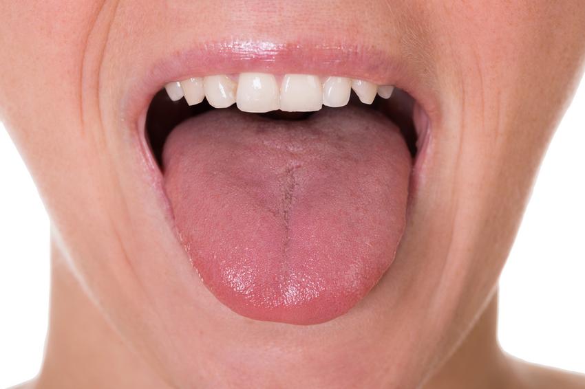 A healthy tongue is pink, shiny, full of tiny bumps in the sense of taste, and there is nothing more than a thin layer of white plaque on it.