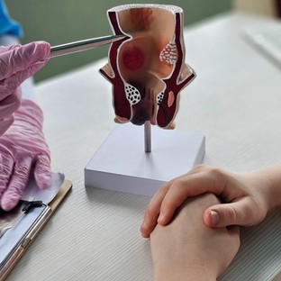 Különös módon emlékeztet a hibáinkra az aranyér: ezt teheti, hogy ne újuljon ki többet