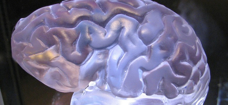 Przełom w walce z Alzheimerem: naukowcy odkrywają komórki, które mogą chronić mózg