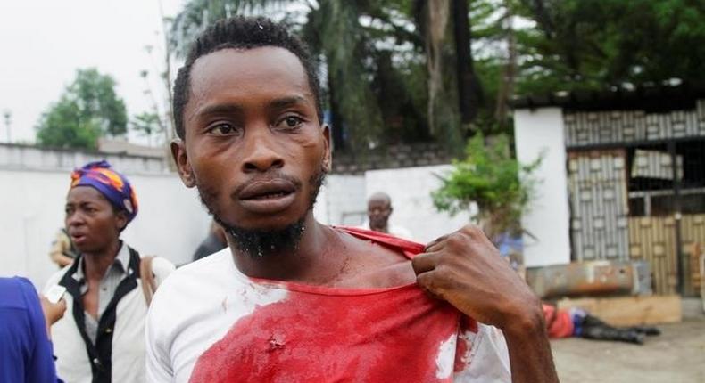 An injured Congolese opposition supporter walks outside the headquarters of the Union for Democracy and Social Progress (UDPS) during violent protests to press President Joseph Kabila to step down, in the Democratic Republic of Congo's capital Kinshasa, September 20, 2016. 