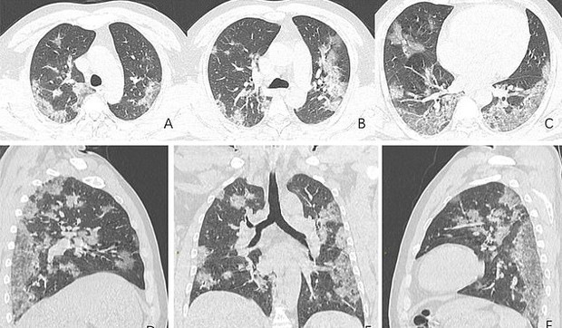 Rendgen snimci preminulog 44-godišnjaka