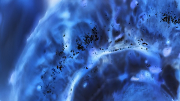 kialakulás előtt diagnosztizálható rák