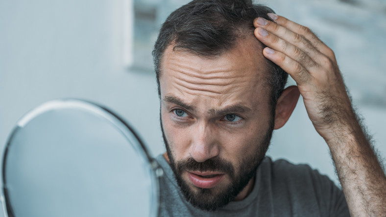 Badania pokazują, że około 40 proc. mężczyzn w naszym kraju boryka się z łysieniem. Mimo tego, że wypadanie włosów u panów jest zjawiskiem powszechnym, wciąż traktowane jest jak temat tabu, a wielu mężczyzn wstydzi się szukać pomocy. Dowiedz się, jakie są przyczyny łysienia, jakie metody przychodzą z pomocą i do jakich specjalistów się zwrócić.
