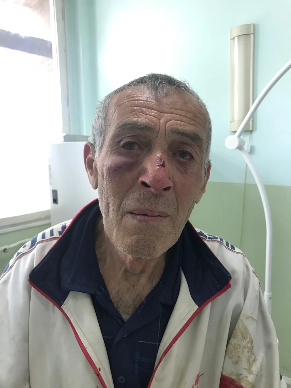 Razvigor Cvetnić jedan je od povređnih na Kosovu