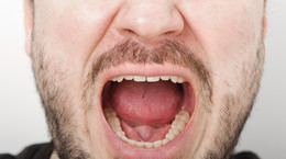 Zmiany w jamie ustnej objawem COVID-19? Lekarze zauważyli je u pacjentów