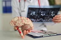 Naukowcy opracowali nowy sposób leczenia choroby Alzheimera. Pomocne mogą być dźwięki