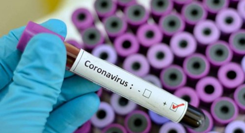 coronavirus blood specimen (GETTY Images)