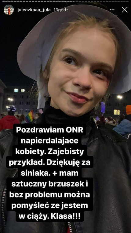 Julia Wróblewska po ataku