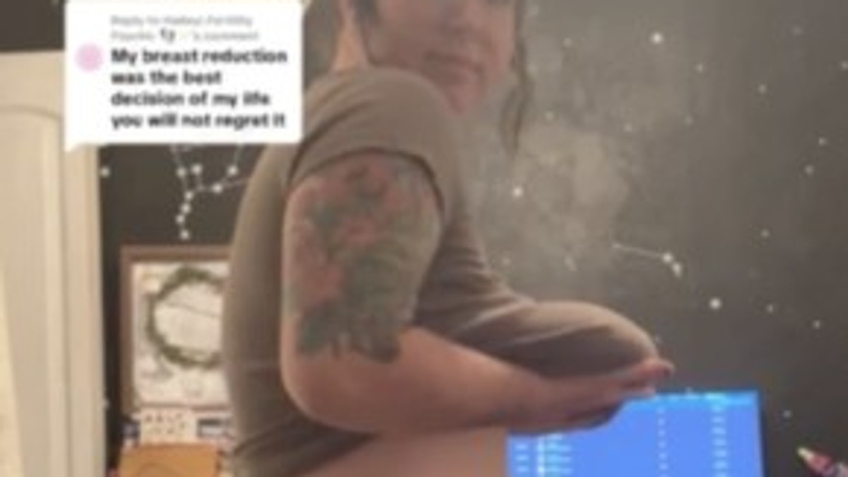 Žena morala da smanji grudi