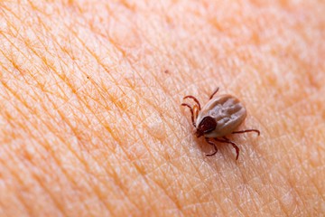 FSME-vírus és Lyme-kór: hogyan különböztethető meg a két, kullancsok által terjesztett betegség?