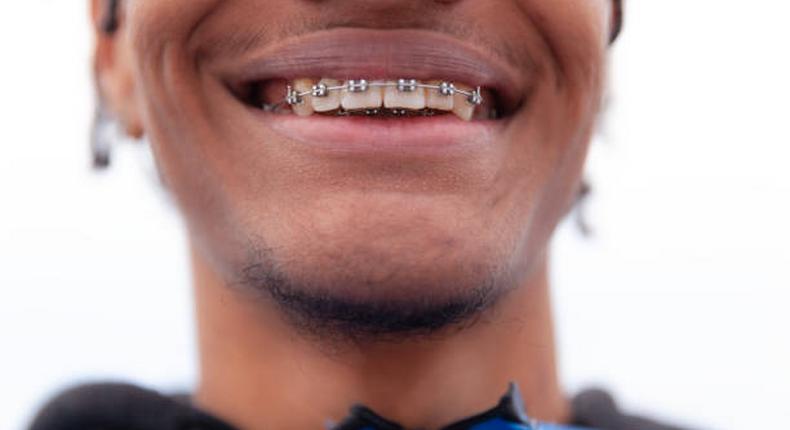 A person with braces