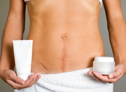 Skąd się biorą blizny i jak je leczyć?