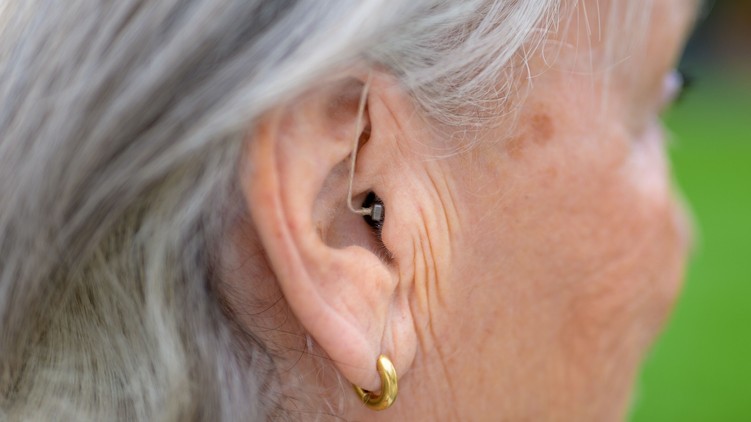 fül mikrofon Alzheimer-kór kutatás